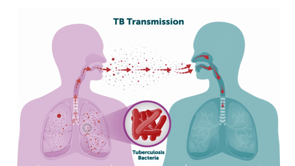 WHO Raises Alarm Over Rising Tuberculosis Cases in Anambra State