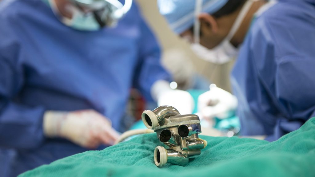 Australian Man Lives Over 100 Days with Artificial Heart in Medical Milestone