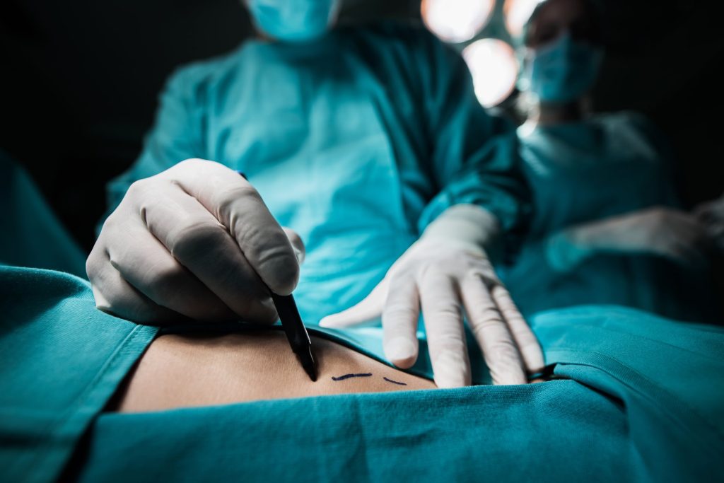 Risks-and-Considerations-of-Cosmetic-Surgery frontpage news