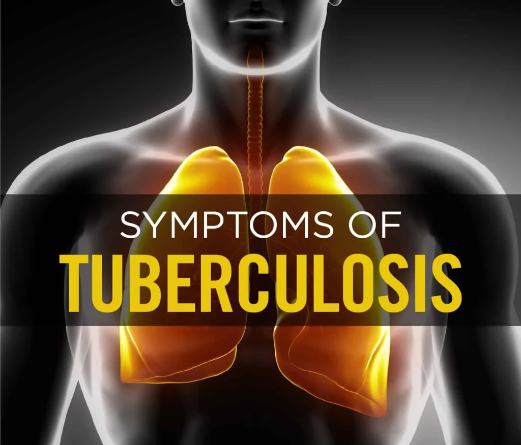 Tuberculosis: A Persistent Global Threat Rekindled by Systemic Failures